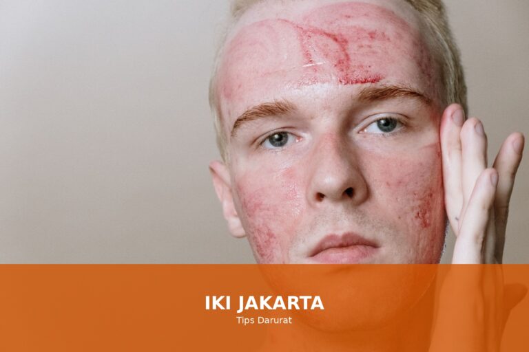 Ilustrasi cara mengatasi luka bakar dengan tips darurat