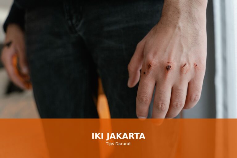 Cara cepat atasi luka lecet dengan langkah praktis